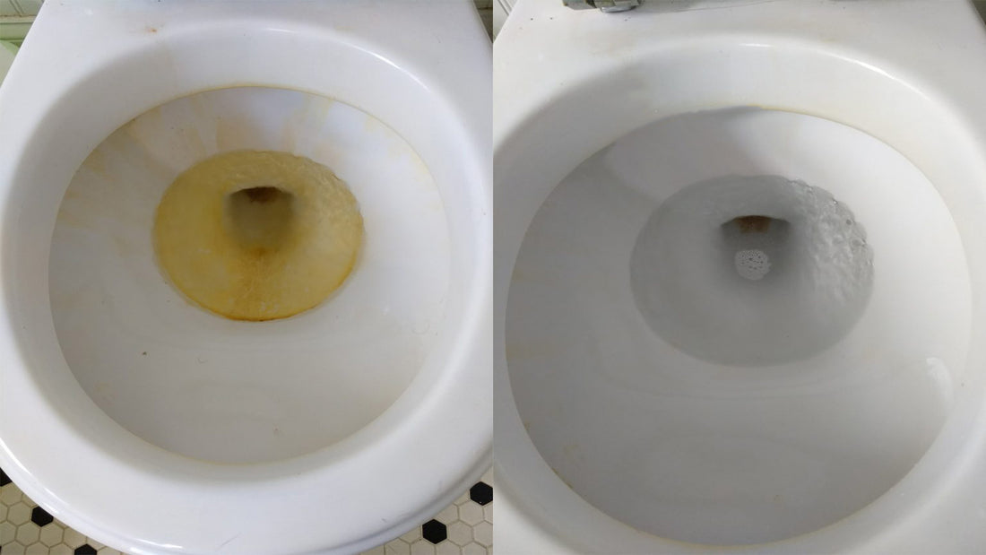 How To Clean Yellow Stains From A Toilet Bowl